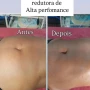 Foto 1:  Alma Feminina Estética